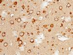 Doublecortin Antibody in Immunohistochemistry (Paraffin) (IHC (P))