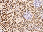 DECR1 Polyclonal Antibody