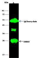DHRS2 Polyclonal Antibody