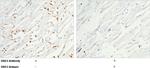 Desmocollin 2 Antibody in Immunohistochemistry (Paraffin) (IHC (P))