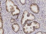 Desmoglein 2 Antibody in Immunohistochemistry (Paraffin) (IHC (P))