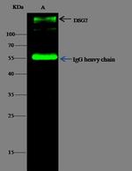 Desmoglein 2 Antibody in Immunoprecipitation (IP)