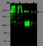 Desmoglein 2 Antibody in Western Blot (WB)