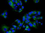 ECE1 Antibody in Immunocytochemistry (ICC/IF)