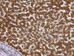 ECH1 Polyclonal Antibody