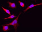 eIF5A Antibody in Immunocytochemistry (ICC/IF)