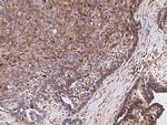 eIF5A2 Antibody in Immunohistochemistry (Paraffin) (IHC (P))