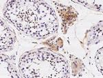 eIF5A2 Antibody in Immunohistochemistry (Paraffin) (IHC (P))