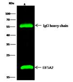 eIF5A2 Antibody in Immunoprecipitation (IP)