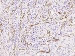 CD105 Antibody in Immunohistochemistry (Paraffin) (IHC (P))
