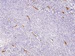 CD105 Antibody in Immunohistochemistry (Paraffin) (IHC (P))