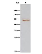 ENO3 Antibody in Immunoprecipitation (IP)