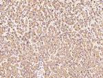 ENPP2 Polyclonal Antibody