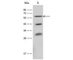 CD39 Antibody in Western Blot (WB)