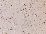 EphB6 Antibody in Immunohistochemistry (Paraffin) (IHC (P))
