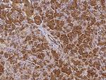 EphB6 Polyclonal Antibody