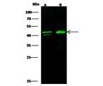 ERCC8 Antibody in Western Blot (WB)