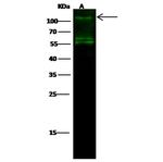 IRE1 alpha Polyclonal Antibody