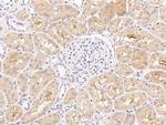 ESAM Polyclonal Antibody
