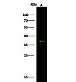 ESAM Polyclonal Antibody