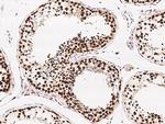 ETV5 Polyclonal Antibody