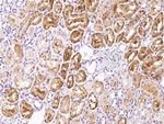 Factor XII Polyclonal Antibody