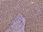 FABP1 Antibody in Immunohistochemistry (Paraffin) (IHC (P))