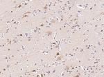 FANCC Antibody in Immunohistochemistry (Paraffin) (IHC (P))