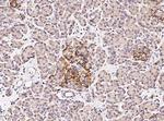 FANCC Antibody in Immunohistochemistry (Paraffin) (IHC (P))