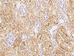 FBXL7 Polyclonal Antibody