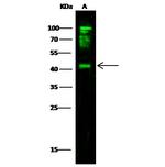 CD64 Antibody in Western Blot (WB)