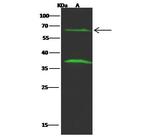 FCRL2 Polyclonal Antibody