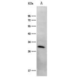 FGF23 Polyclonal Antibody