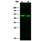 Fumarase Polyclonal Antibody