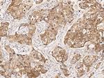 FHIT Antibody in Immunohistochemistry (Paraffin) (IHC (P))