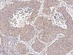 FHIT Antibody in Immunohistochemistry (Paraffin) (IHC (P))