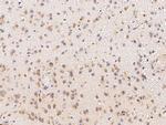 FKBP14 Antibody in Immunohistochemistry (Paraffin) (IHC (P))