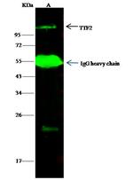 TTF2 Antibody in Immunoprecipitation (IP)