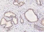 GABARAPL2 Antibody in Immunohistochemistry (Paraffin) (IHC (P))