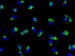 GALNT2 Polyclonal Antibody