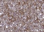 GGCT Antibody in Immunohistochemistry (Paraffin) (IHC (P))