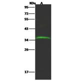 GLT8D2 Polyclonal Antibody