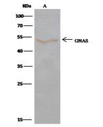 GNAS Antibody in Immunoprecipitation (IP)