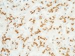 GOLPH2 Antibody in Immunohistochemistry (Paraffin) (IHC (P))