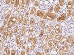 GPD1 Polyclonal Antibody