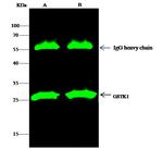 GSTK1 Antibody in Immunoprecipitation (IP)