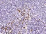 GYPC Polyclonal Antibody
