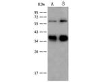 GYPC Antibody in Western Blot (WB)