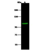 HDAC7 Polyclonal Antibody