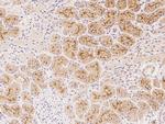 HGF Polyclonal Antibody